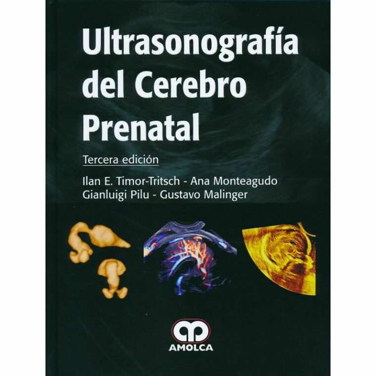 Ultrasonografía del Cerebro Prenatal