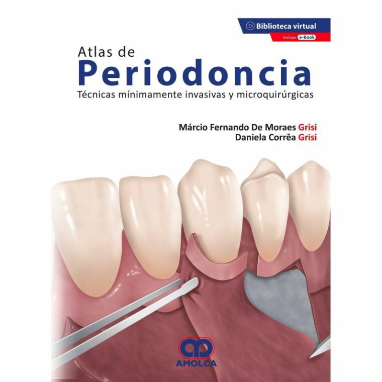 Atlas de Periodoncia. Técnicas Mínimamente Invasivas y Microquirúrgicas