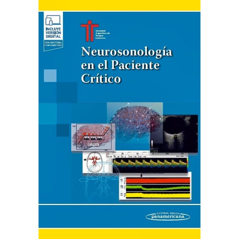 Neurosonología en el Paciente Crítico